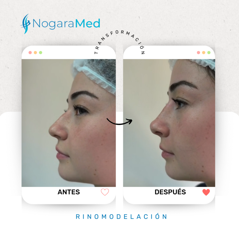 Beige Minimalist Before and After Makeup Transformation Instagram Post (1)